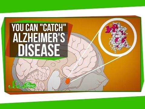 Catching Alzheimer’s: News or Nonsense?