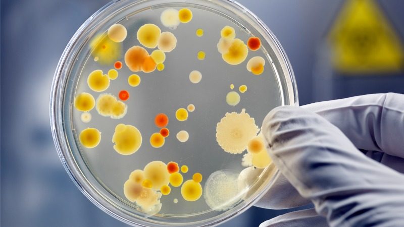Bacteria in the Mouth Linked to Pulmonary Fibrosis Survival