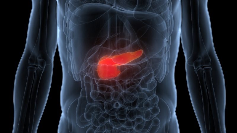 AI Model Flags High-Risk Pancreatic Cancer Patients 18 Months Before Diagnosis
