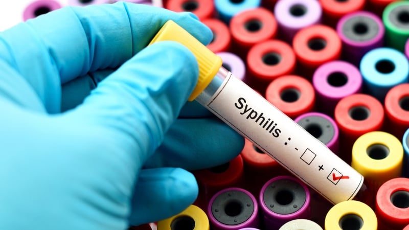Surge in Syphilis Cases Leads Some Providers to Ration Penicillin