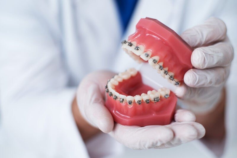 Choosing the Right Orthodontic Clinic for You and Your Family: A Comprehensive Guide