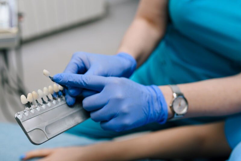 Resin Veneers vs Porcelain Veneers – What’s the Difference?