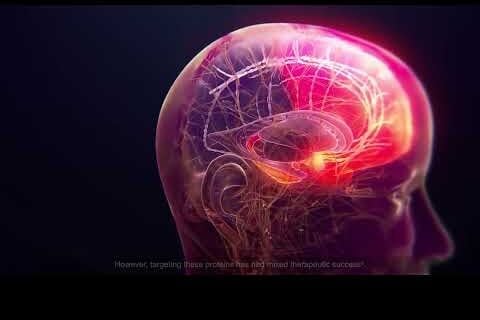 Xanamem for Alzheimer’s Trial: A Single Pill Once a Day