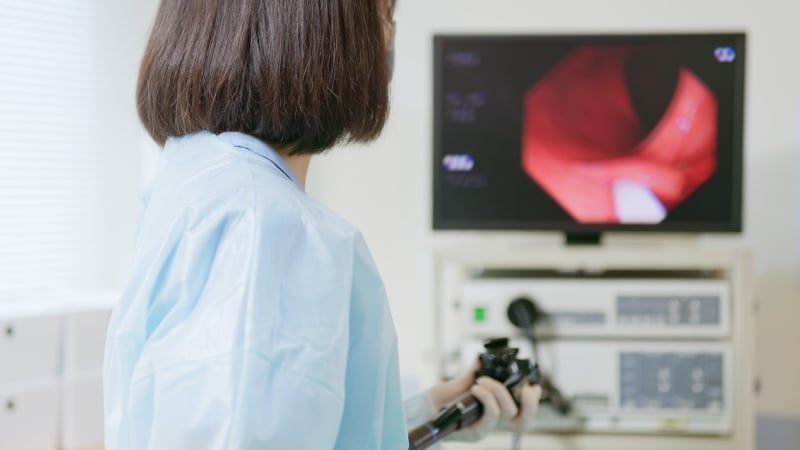 AI Analysis of Colonoscopy Improves Assessment of Crohn’s Disease