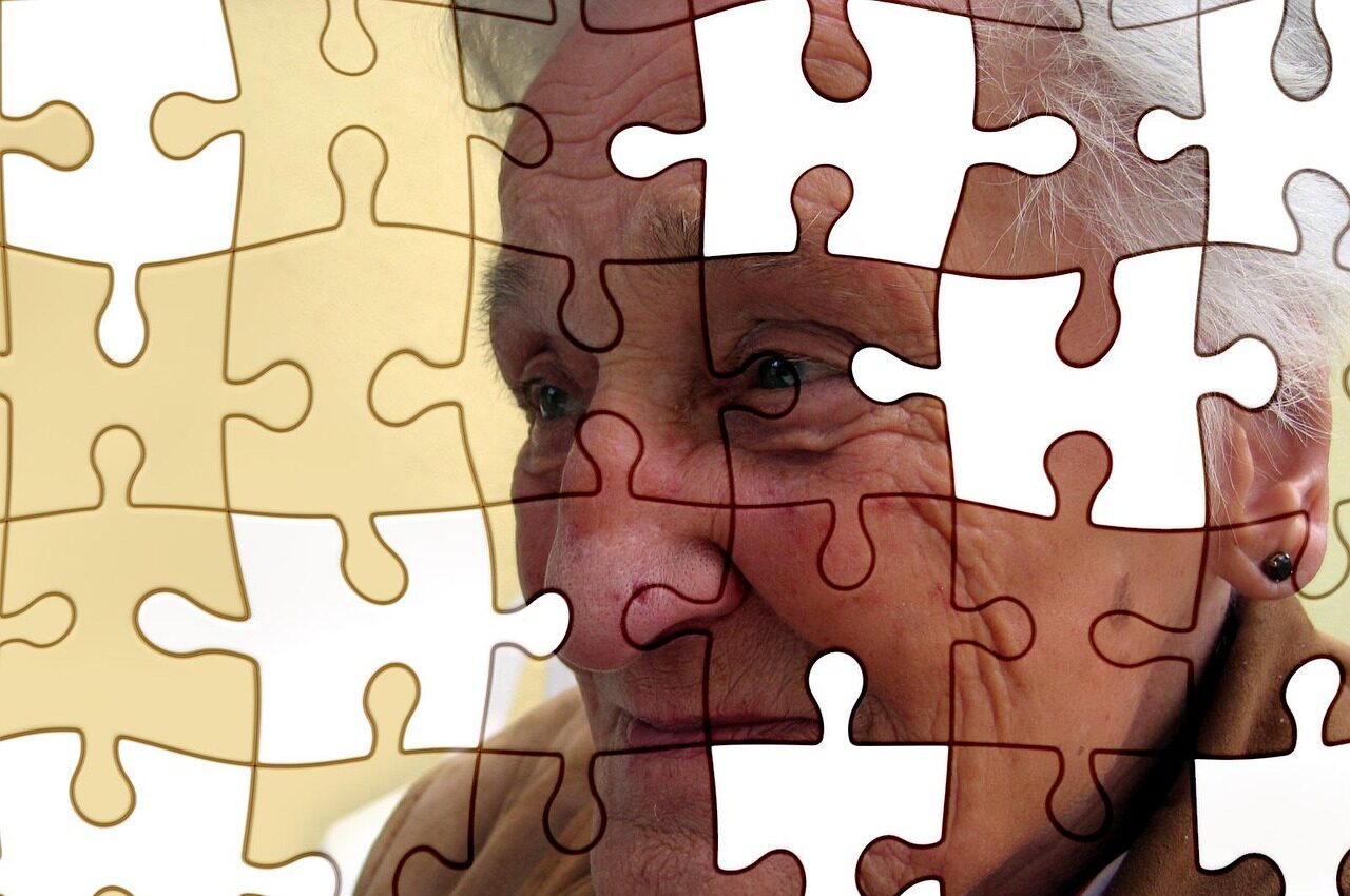 Rapidly Progressive Dementia: When Decline Moves Faster Than Expected