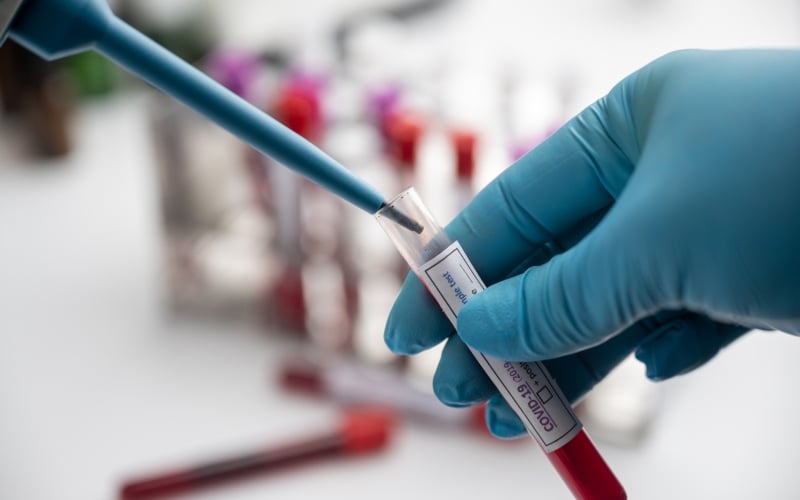 Researchers Develop Models to Help Diagnose ALS Earlier Through Blood Biomarkers