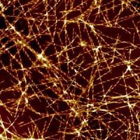 7 Steps to Alzheimer’s