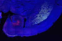 Why Does Alzheimer’s First Attack the Neurons That Hold Our Memories?