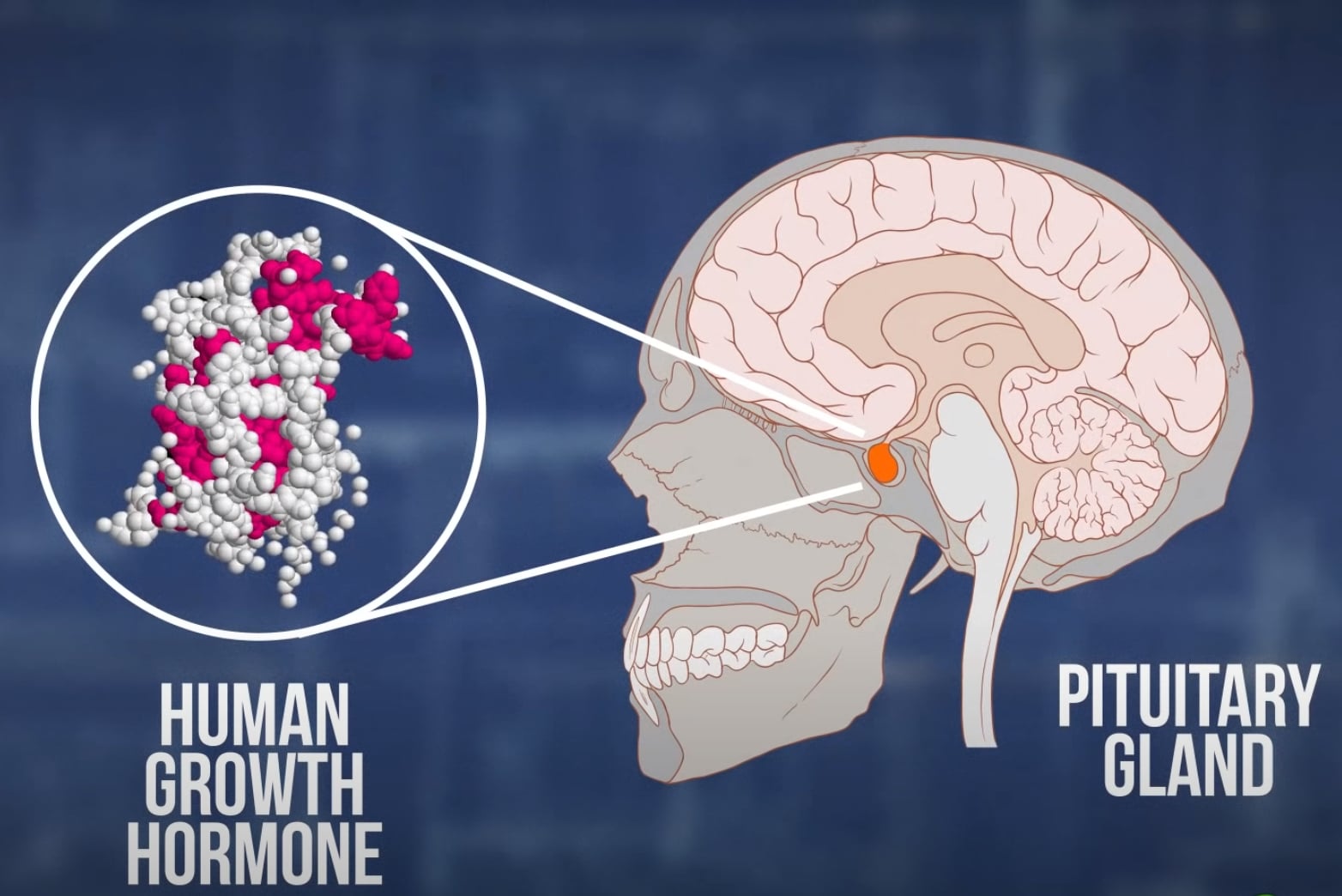 Catching Alzheimer’s: News or Nonsense?