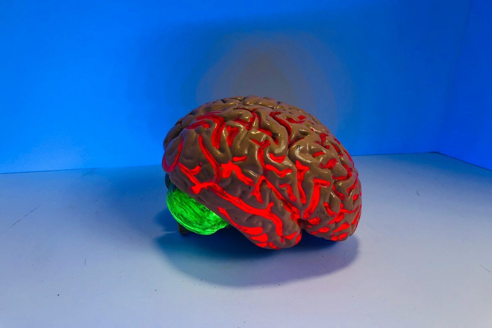 Blood Flow to the Brain Gets Blocked by Alzheimer’s Plaque