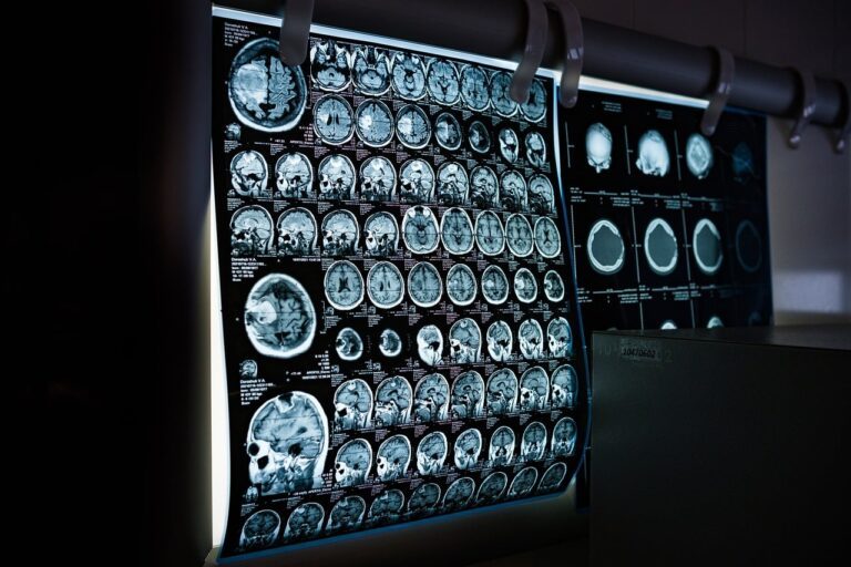 11 Myths About Alzheimer’s