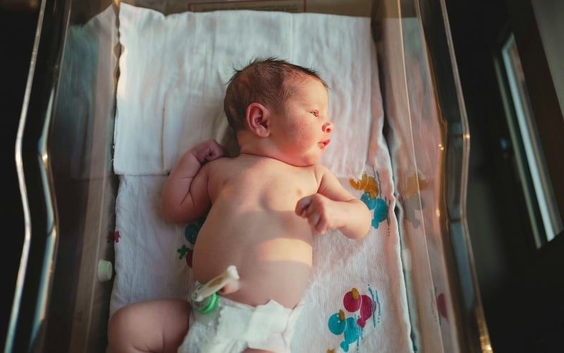 Male Circumcision Just After Birth Doesn’t Raise Autism Risk